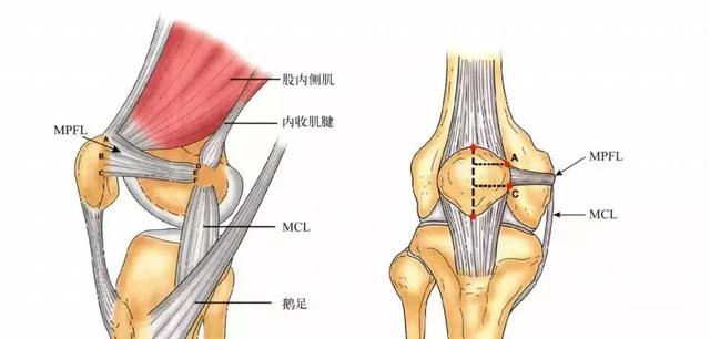 内侧股四头肌,内侧斜肌(vmo)张力下降50%可导致髌骨5mm的侧向移位.