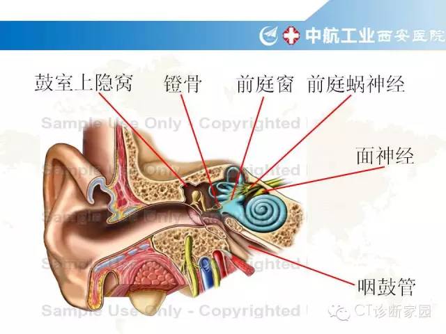 颞骨断层解剖及病例解读_蝶骨