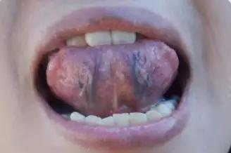 c3bc59d9e7b94bd593147e24dcf46f86.JPG