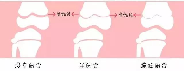 爱知教学园地：5-18岁身高对照表，你家孩子达标了么？预防矮小，这三点要注意了