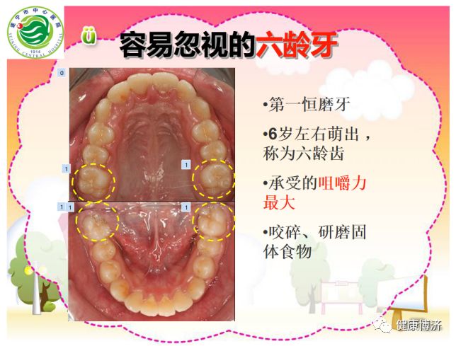 龋齿就是蛀牙,但不是长了虫