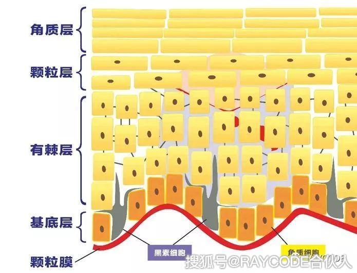 人体皮肤分为表皮层,真皮层和皮下组织.