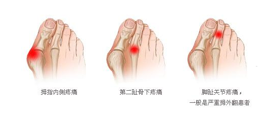 什么骨立成语_成语故事图片