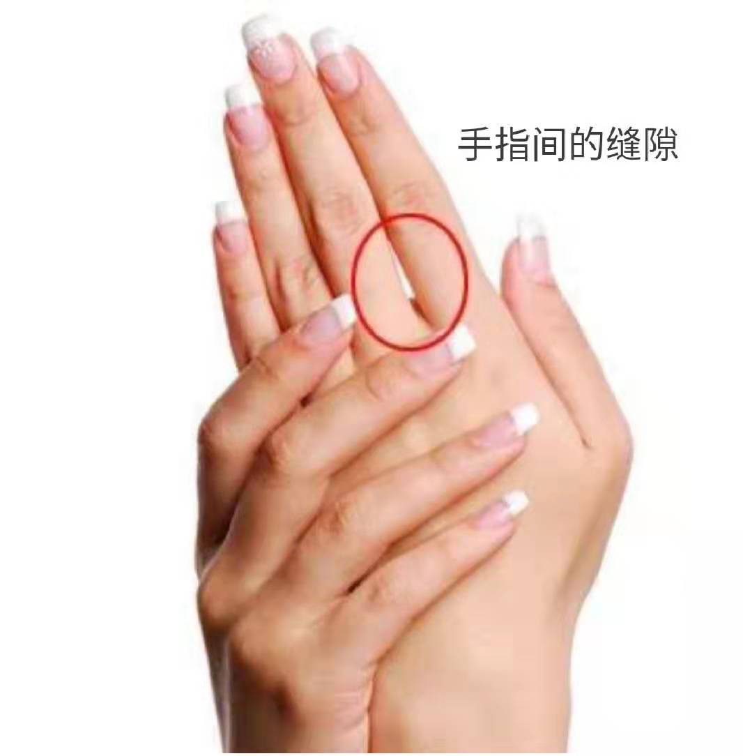 怎么能快速止住手指上的血 165b843794ca42d2818a3d5201c429f0.jpeg