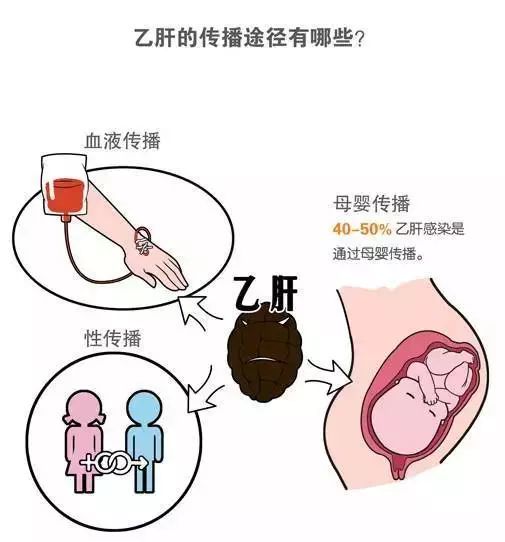 预防艾滋病,梅毒和乙肝母婴传播