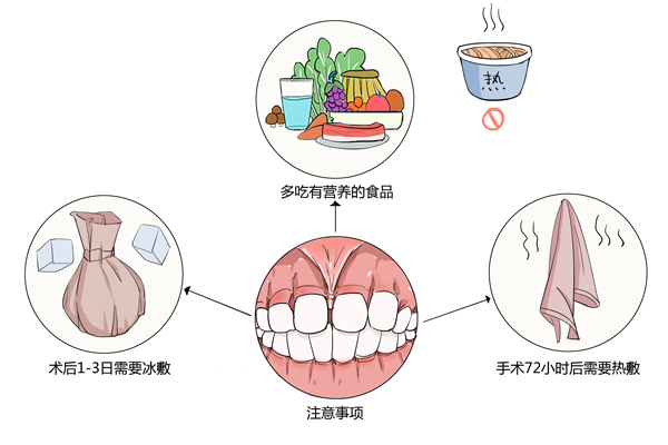 下唇系带断了怎么办