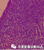 89a59bffa00a437fb959c86013fce311.png