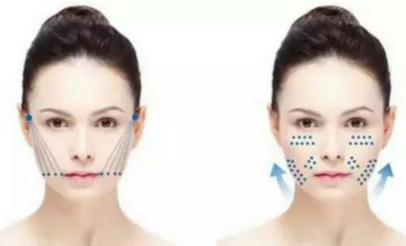 皮肤修复过程中可能的副作用 ab041f5286464b0d9bfc175dd0fd4308.png