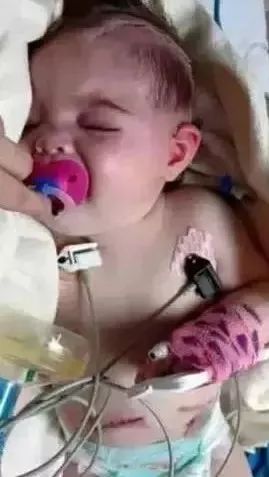 纽诺育儿王荣辉@英国8个月大婴儿被摇晃致脑出血：不懂哄睡有多可怕？
