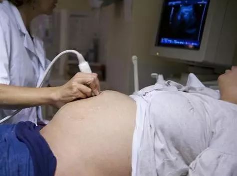 怀孕多久属于引产 e7e40445a87c4ba7966ed4760b6386c0.jpeg