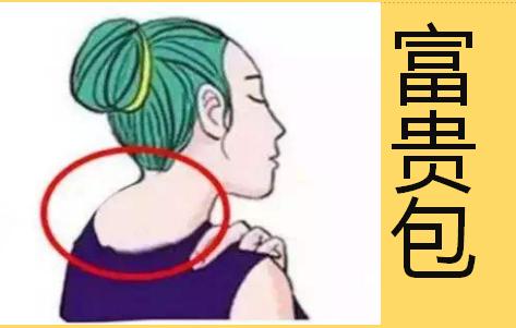 怎么拉伸肩背和后颈 38af5d76bdd3441191cee28f1ed1d34c.jpeg