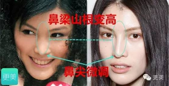 怎么才算高鼻梁侧脸 51acacb3ba1e45f9b3180ee6df82e837.jpeg