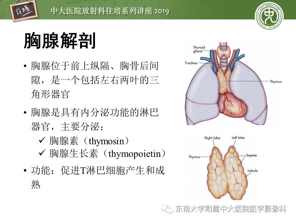 【2019住培系列讲座 第78期】胸腺上皮性肿瘤的影像诊断及鉴别