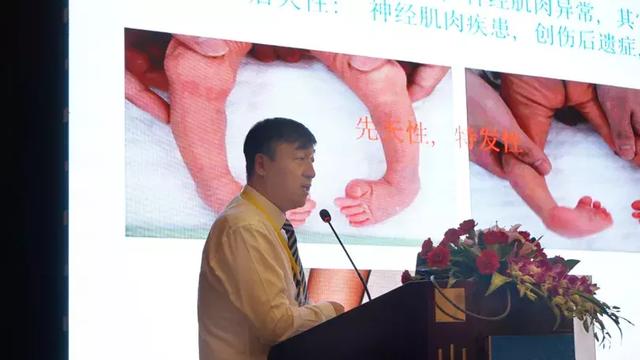 张涛教授分享《新型跟骨外固定架治疗跟骨骨折》张定伟教授分享《胫骨