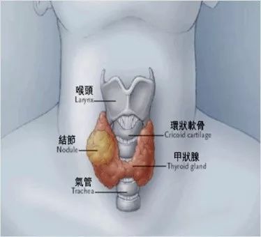 甲井怎么办