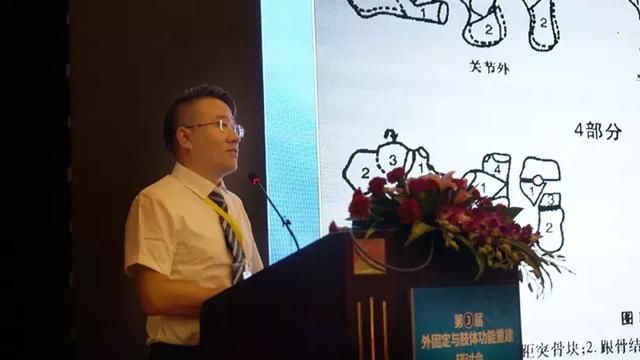 张定伟教授分享《胫骨横向搬移微循环重建技术治疗缺血性足病》朱跃良