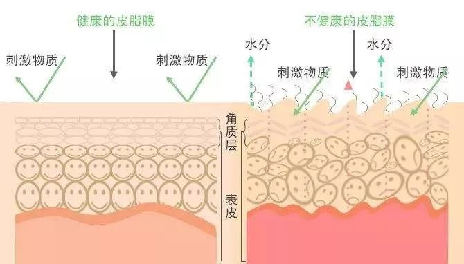 秋天皮肤干燥怎么办?