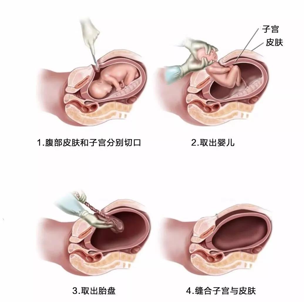 胖姑娘们的生育问题