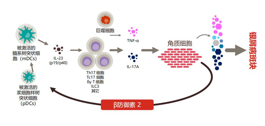 中国银屑病白介素元年背后进化史与净化论