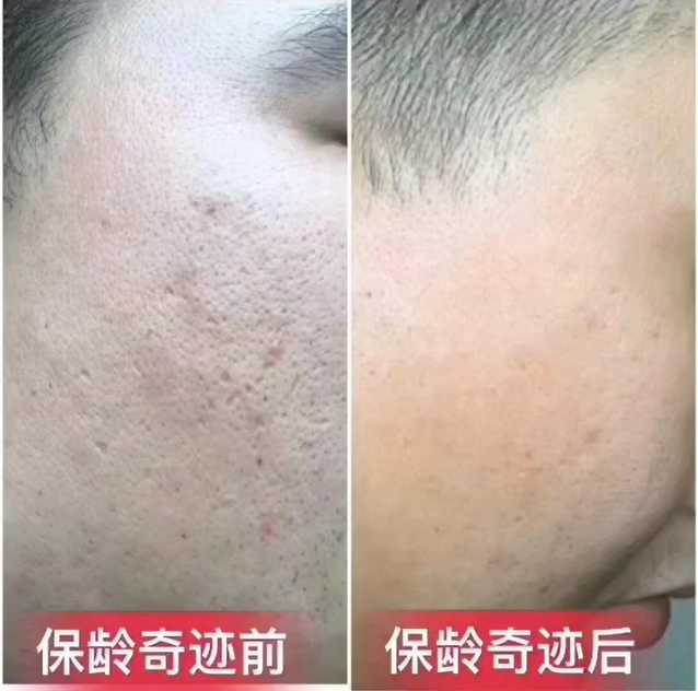 皮肤保护膜坏了怎么办 0cd0168907bc4126b08b944db4c9eb2a.png