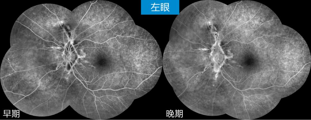 每周最佳病例分享它一定很爱你它在你眼睛里