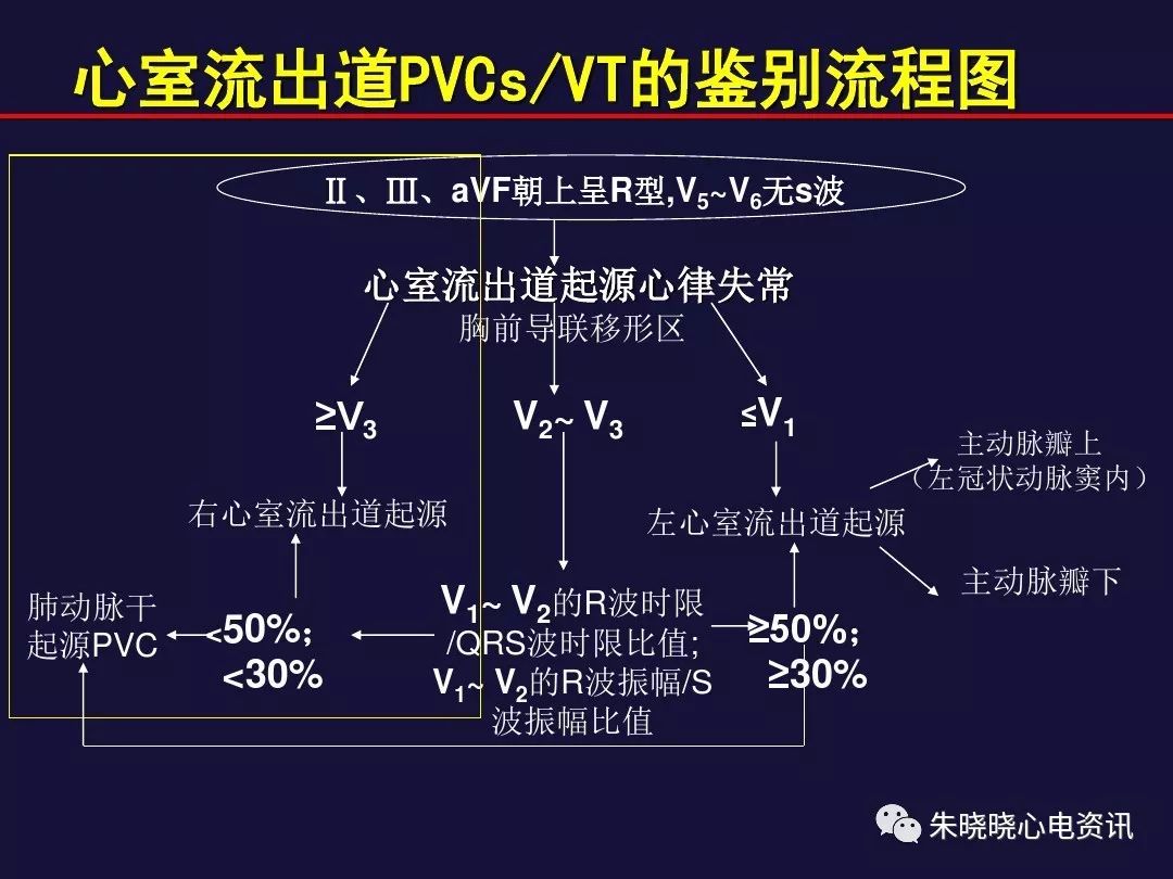 室性早搏室性心动过速的体表心电图定位