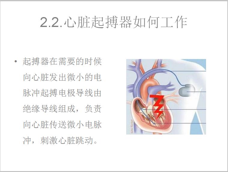 心脏起搏器价格表2020 c29838480aed43349902cca33946f271.jpeg