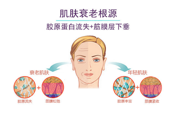 如何瘦下巴的脂肪 54f8ed36823d41fc979a5d5250a16970.png