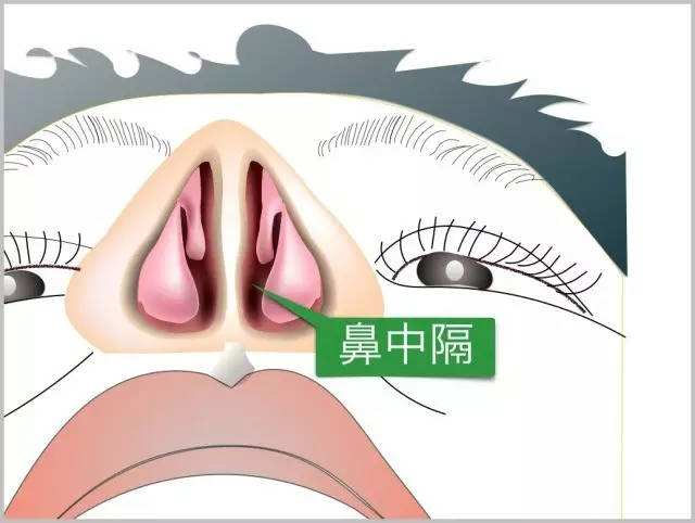 首大李霞:鼻中隔偏曲应该怎么治疗?