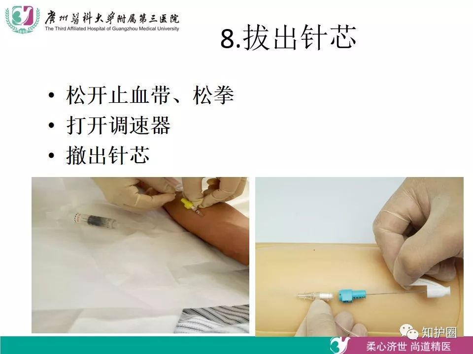 【ppt】静脉留置针穿刺技术及静脉管道的维护