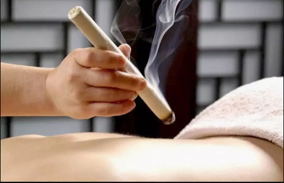 针灸排名_中医针灸图片(3)
