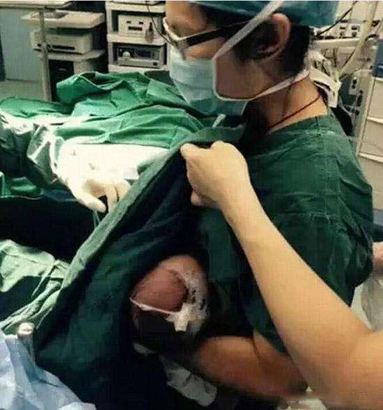 孕婴帮：原创宝宝出生被剪脐带的瞬间，这下意识的动作秒变表情包，让医生笑喷