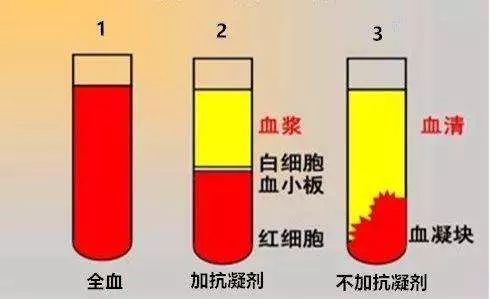 ivd检测项目使用全血,血清,血浆标本分类大汇总!_血液