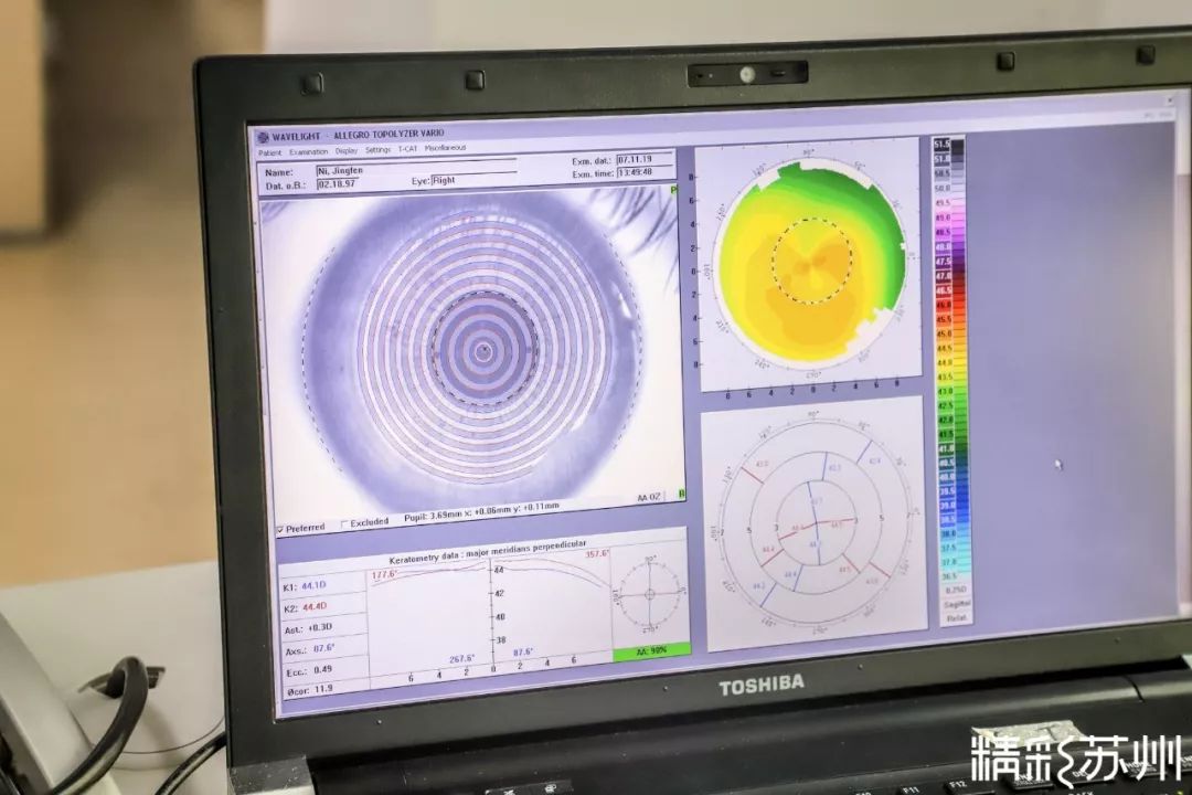 怎么自己测量散光 15cb2fafa98547e1bd9e3b22e0152428.jpeg