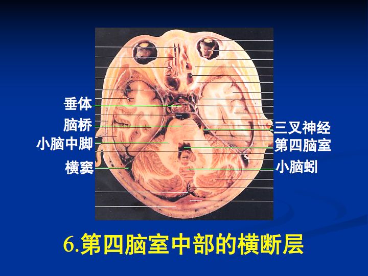 神经解剖脑室系统解剖及第三脑室病变常见手术入路南昌大学一附院徐春