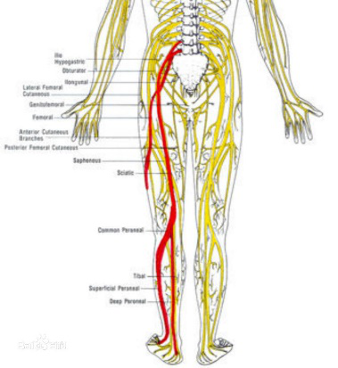 坐骨神经痛怎么治最快有妙招!