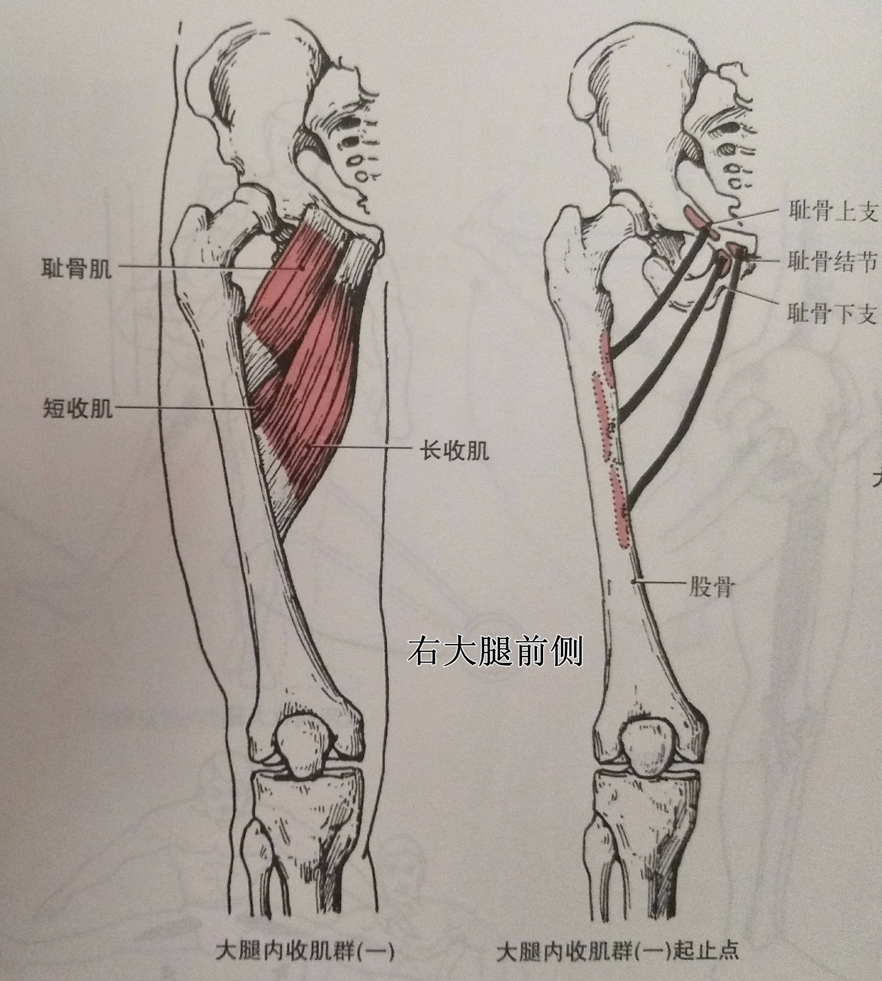 紧张,缩短肌肉: 大腿内收肌:x腿股骨会过于内收,从而缩短内收肌群