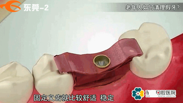 老年人应该如何正确清洁假牙呢