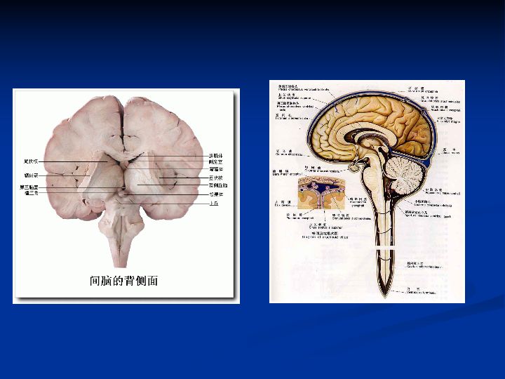 神经解剖| 脑室系统解剖及第三脑室病变常见手术入路