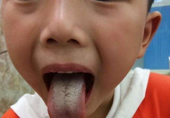 【90后俏妈育儿】孩子出现3种症状，说明是典型的脾虚，别等孩子瘦成豆芽了才察觉