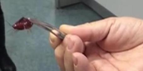 凡凡情感■原创2岁男童哭喊耳朵痛，医生检查发现鼓膜被啃，取出一看家长傻眼！