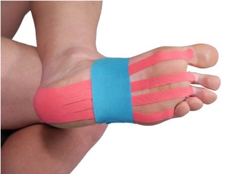 足底筋膜炎的肌效贴扎法_张力并