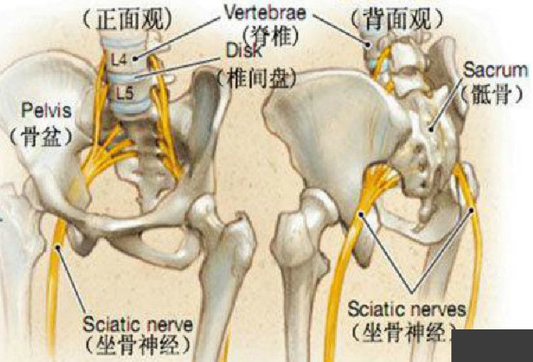 什么是坐骨神经疼痛 bc3a9d2da3aa4bbeac5567d47c530ec8.jpeg
