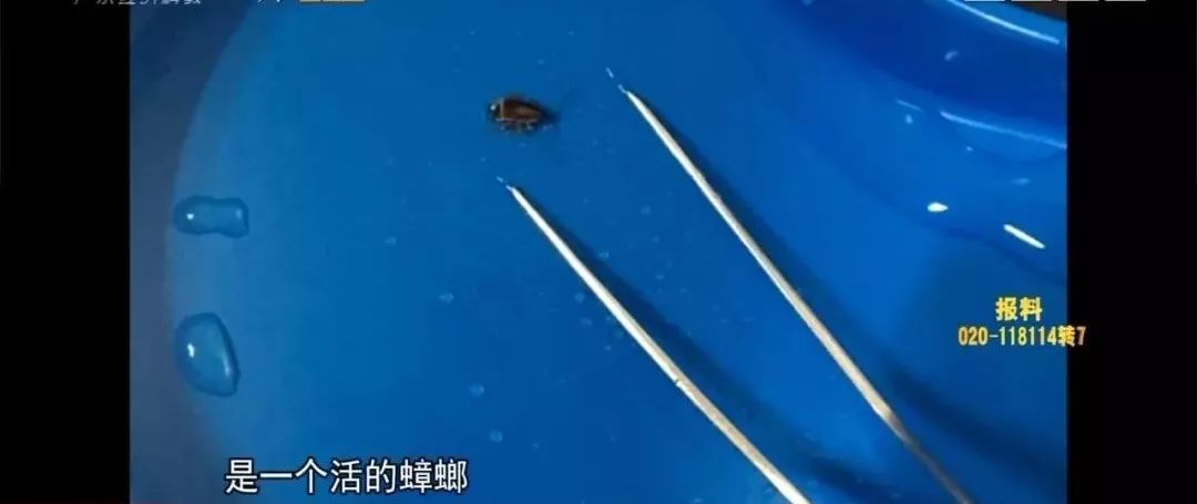 [广东活动]广东2岁男孩哭闹不止，医生从他耳朵里掏出活蟑螂：它在啃食…
