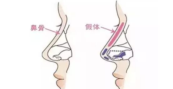 2022【成都鼻修复技术好的医生名单+项目收费价格表新版公开一览】