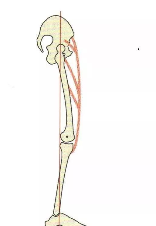 体态康复:下肢肌力失衡造成姿势和步态异常_骨盆