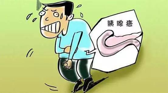 癌中之王:胰腺癌早期没有典型症状,6成被误诊早期常表现为腹痛,腹胀