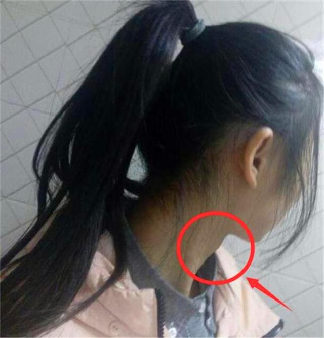 「妈妈育儿汇」13岁女孩冒出喉结，长出胡子：这些零食，家长别再买给孩子了