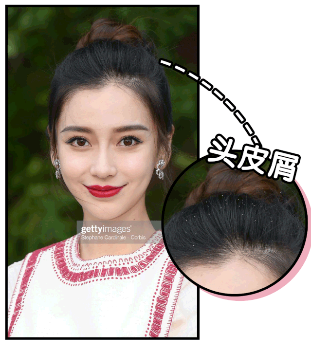 因为这一点,毁了神仙颜值!