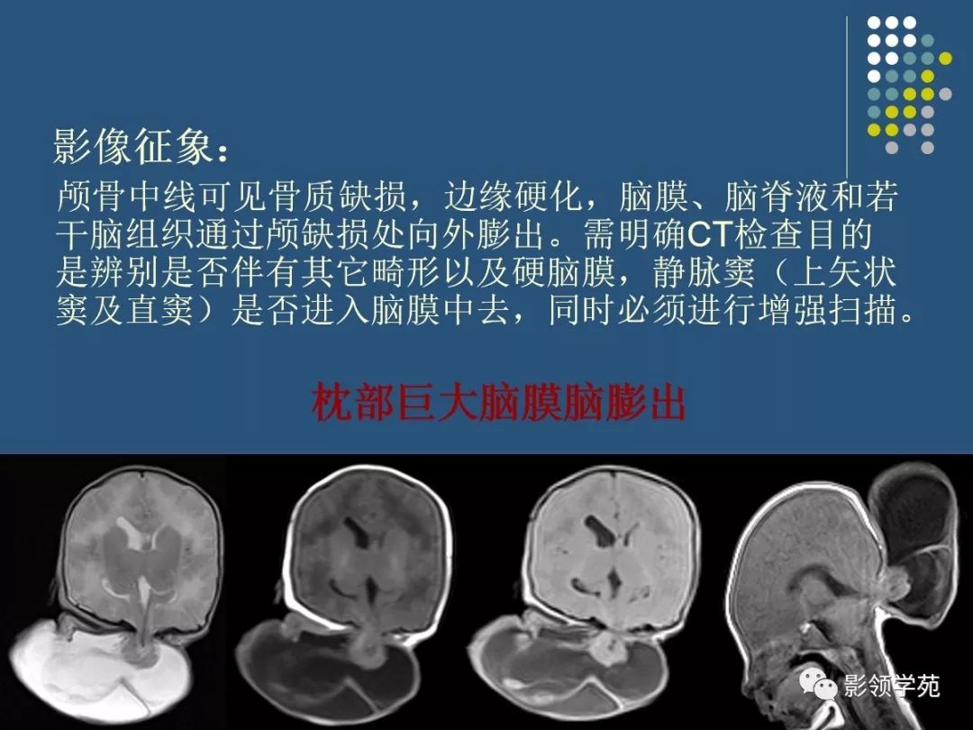 颅脑先天性疾病影像诊断